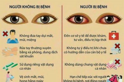 PHÒNG BỆNH ĐAU MẮT ĐỎ